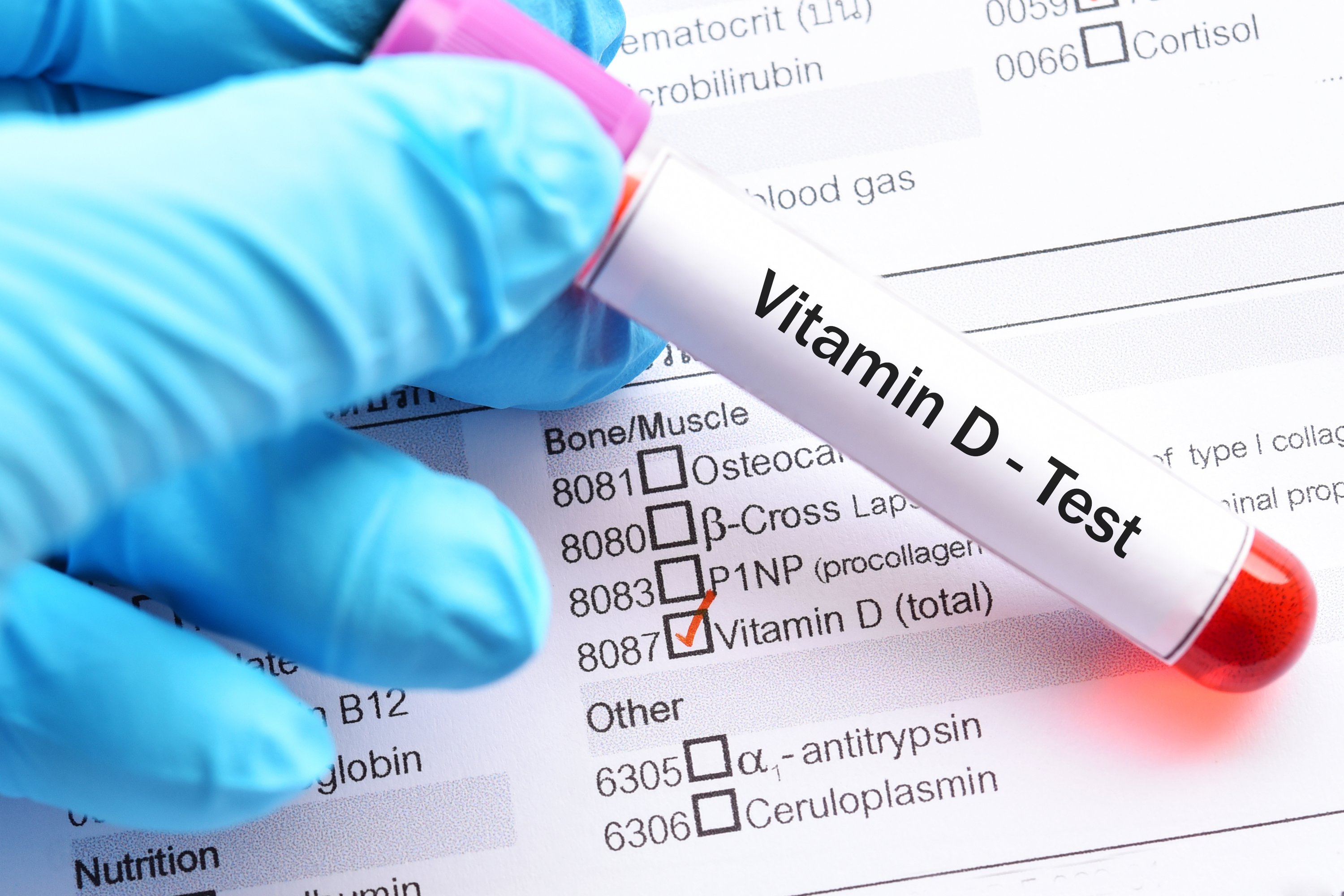 Vitamin D test sample