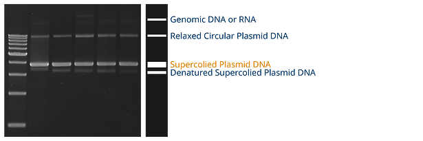 Analyzing Plamid DNA Gel Electrophoresis