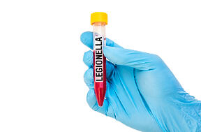 bigstock-Test-tube-With-Blood-Sample-Fo-143507297