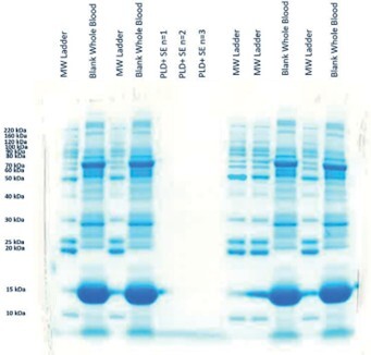 biotage-an985-figure5-Gel-Electrophoresis-on-whole-blood