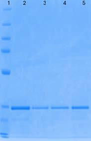 biotage-pps757-figure2-sds-page-gel-image-eluted-samples-each-platform