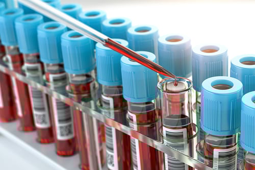 bigstock-Blood-test-samples-tubes-and-b-346323679