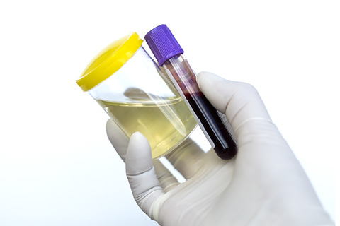 Urine and Blood