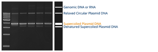 Analyzing Plamid DNA Gel Electrophoresis