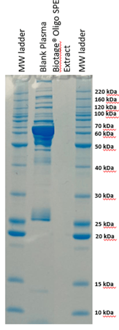 an1027-biotage-figure-7-SDS-page-comparison-of-blank-plasma-and-biotage-oligo-spe-processed plasma